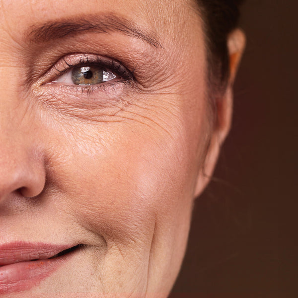 Rugas e Linhas de Expressão